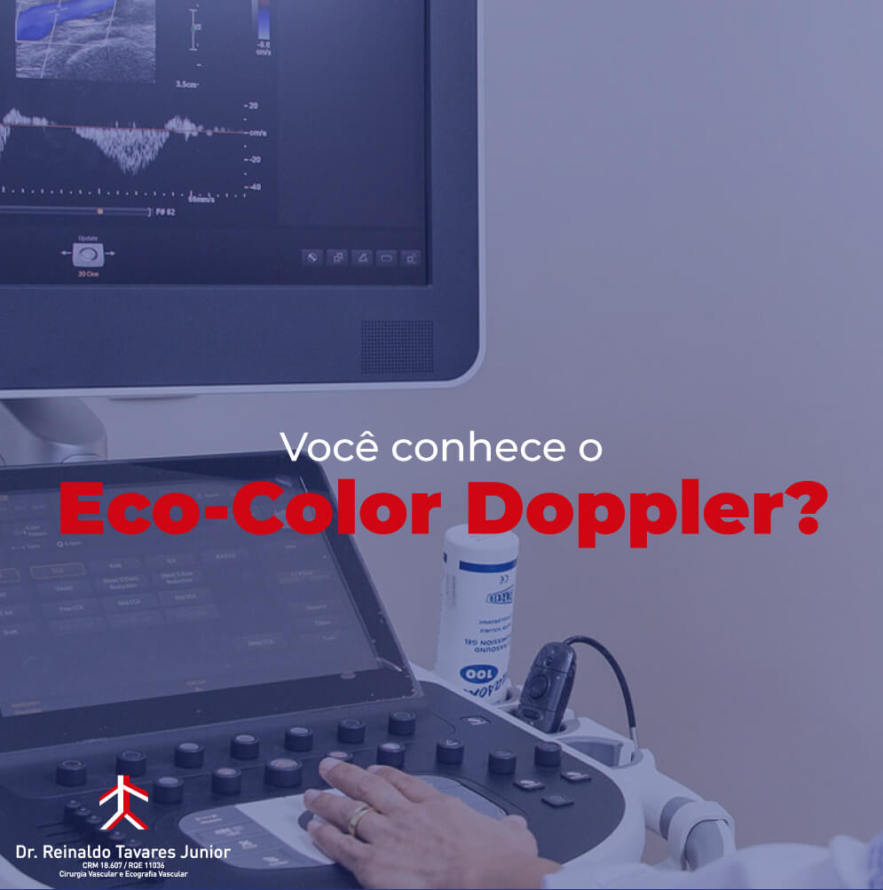 Conheça o Eco-Color Doppler