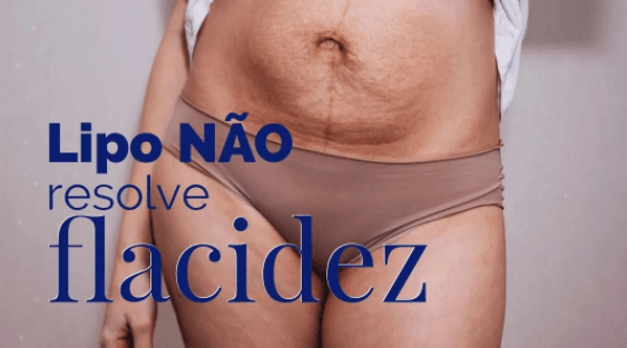 Lipo não resolve flacidez!