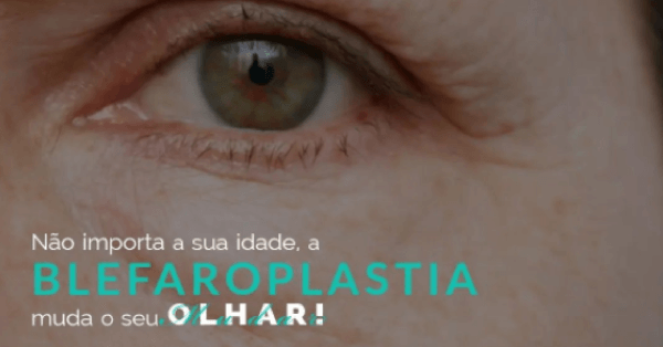 A blefaroplastia muda o seu olhar!