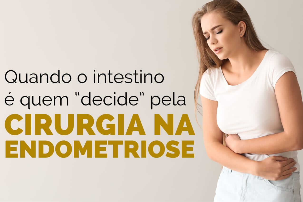 Endometriose: Quando é o intestino quem "decide" pela cirurgia?