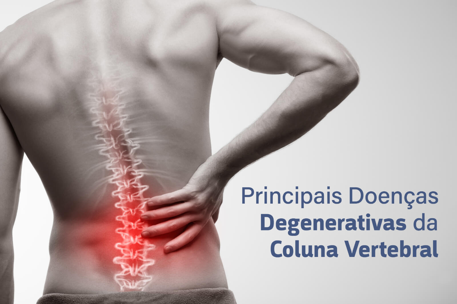 Principais Doenças Degenerativas da Coluna Vertebral