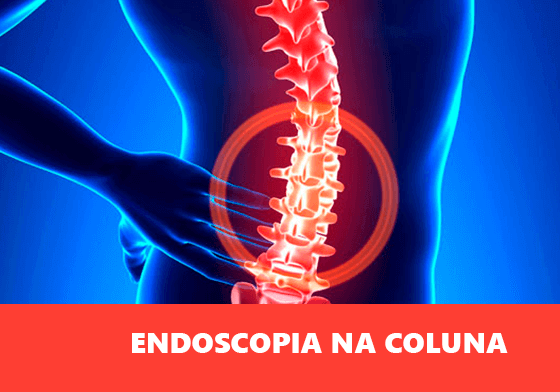 Endoscopia na coluna