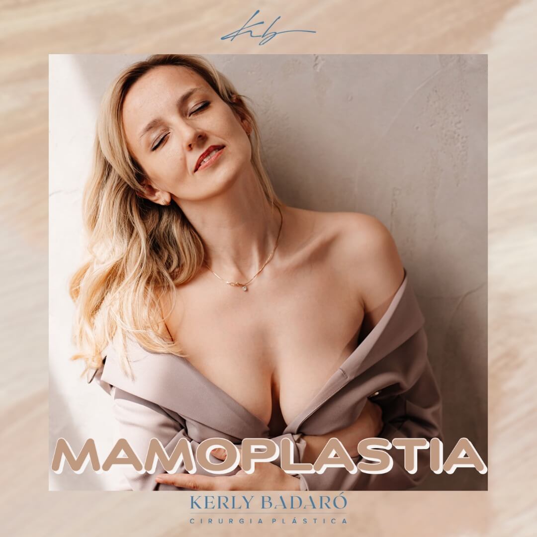 Mamoplastia