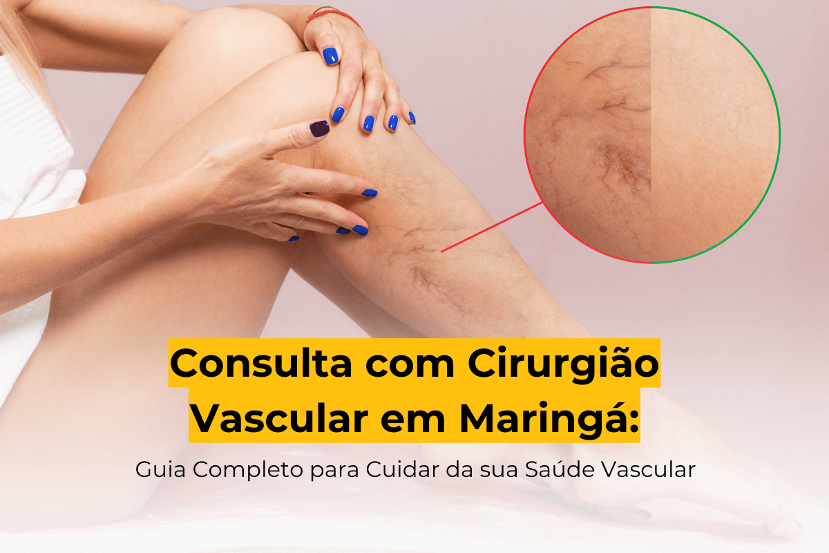 Consulta com Cirurgião Vascular em Maringá: Guia Completo para Cuidar da sua Saúde Vascular