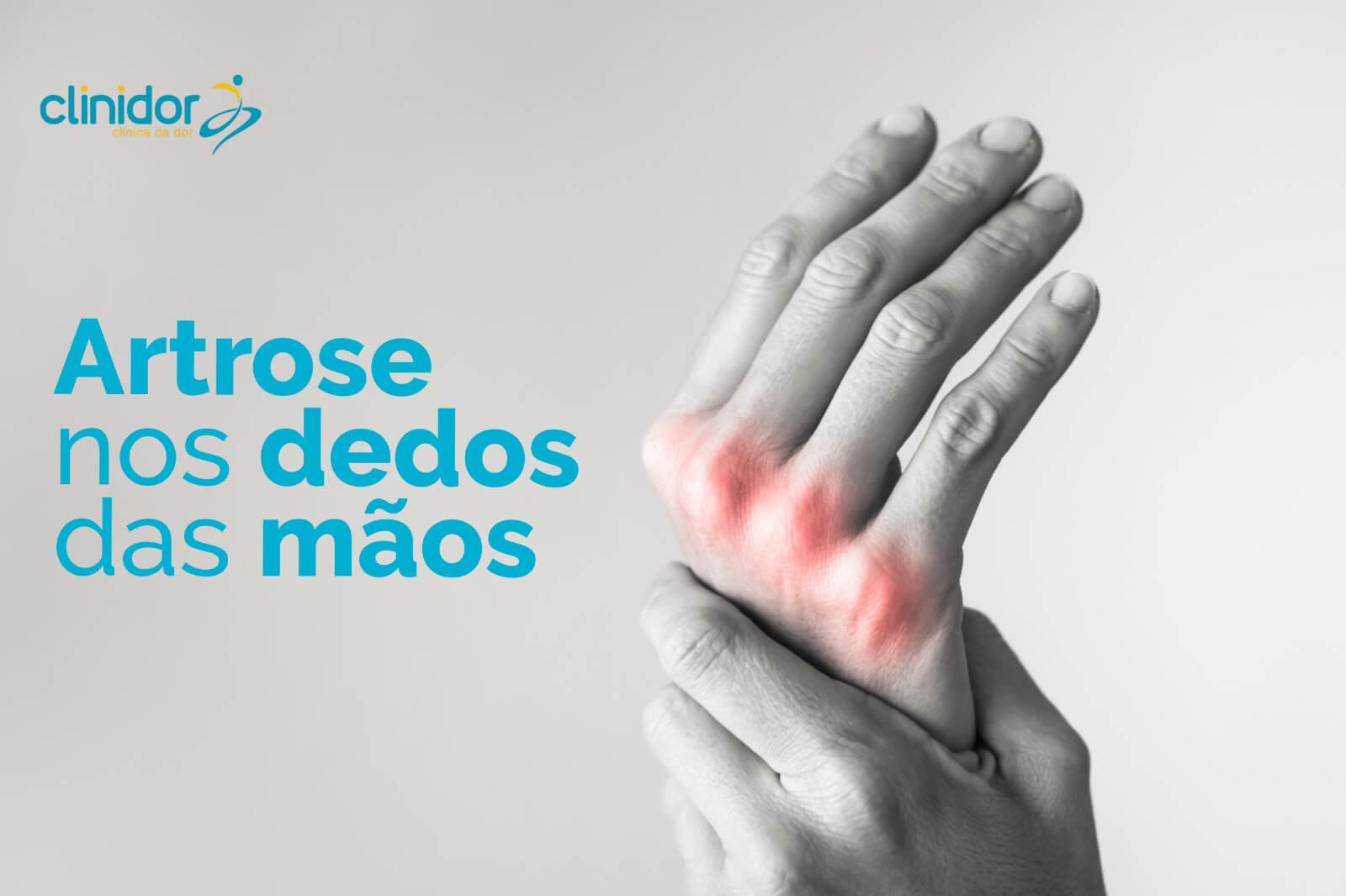 Artrose nos dedos das mãos