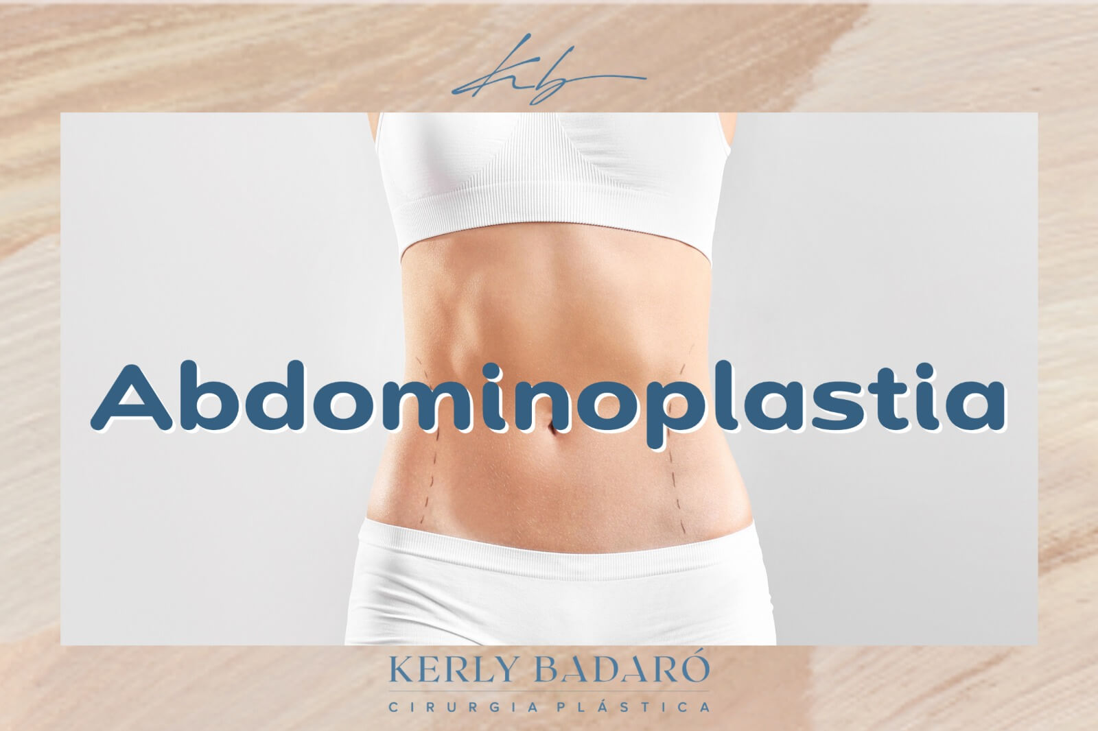 Abdominoplastia