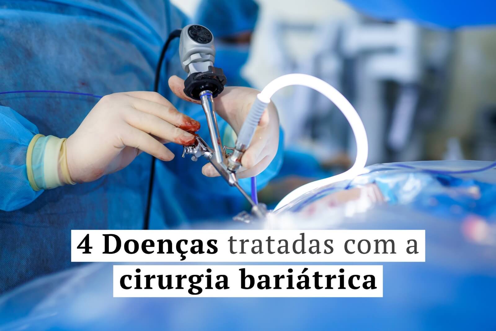 4 Doenças tratadas com a cirurgia bariátrica