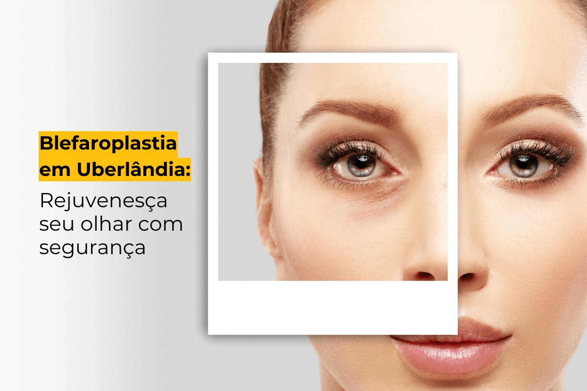 Blefaroplastia em Uberlândia: Rejuvenesça Seu Olhar com Segurança