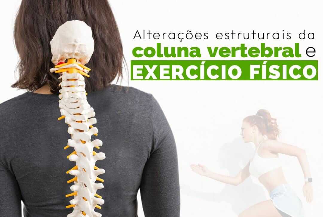 Alterações estruturais da coluna vertebral e exercício físico 