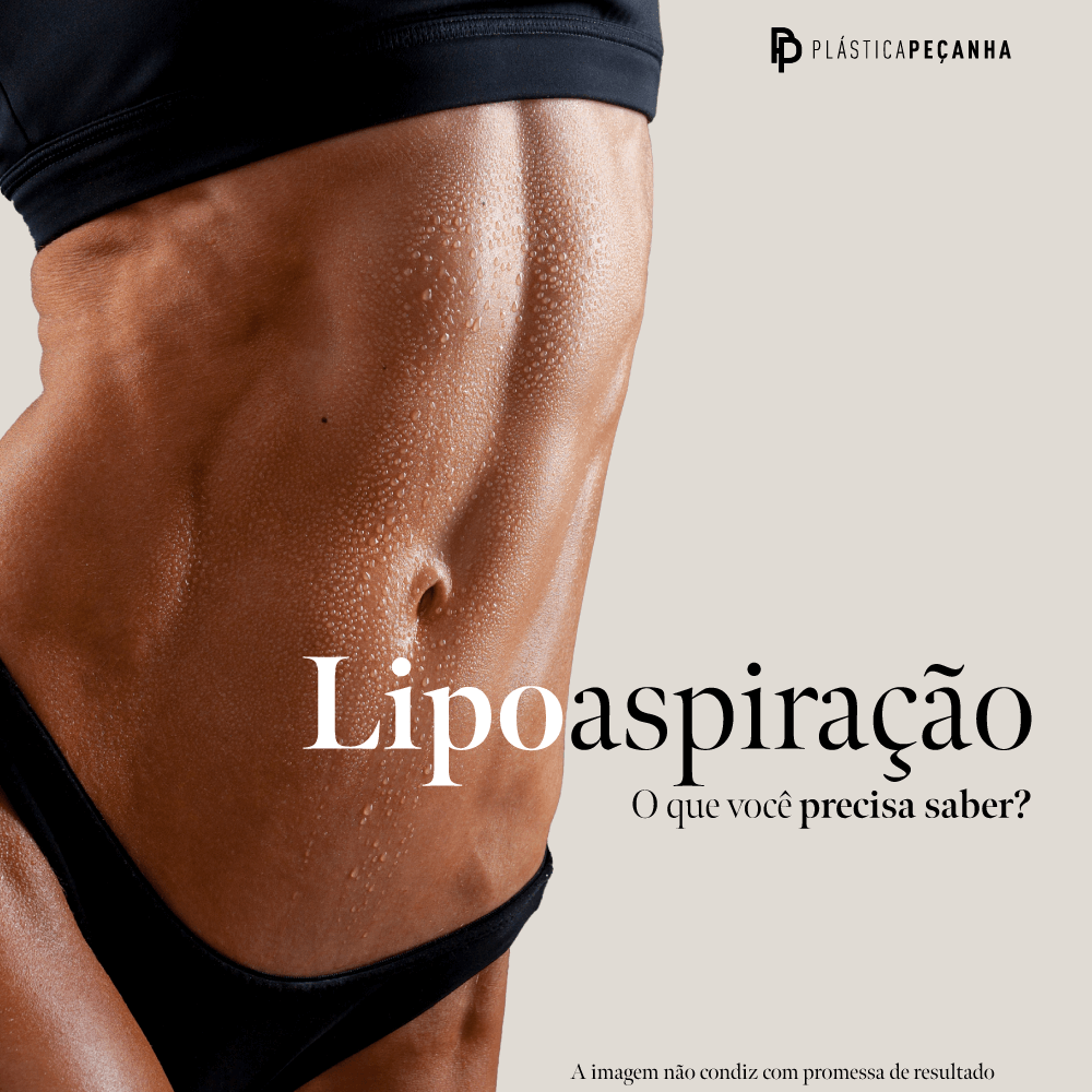 Lipoaspiração - O que você precisa saber?