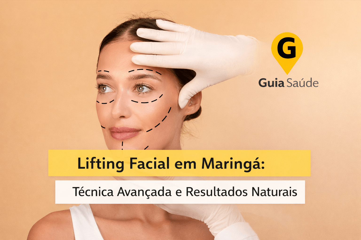 Lifting Facial em Maringá com Técnica Avançada e Resultados Naturais