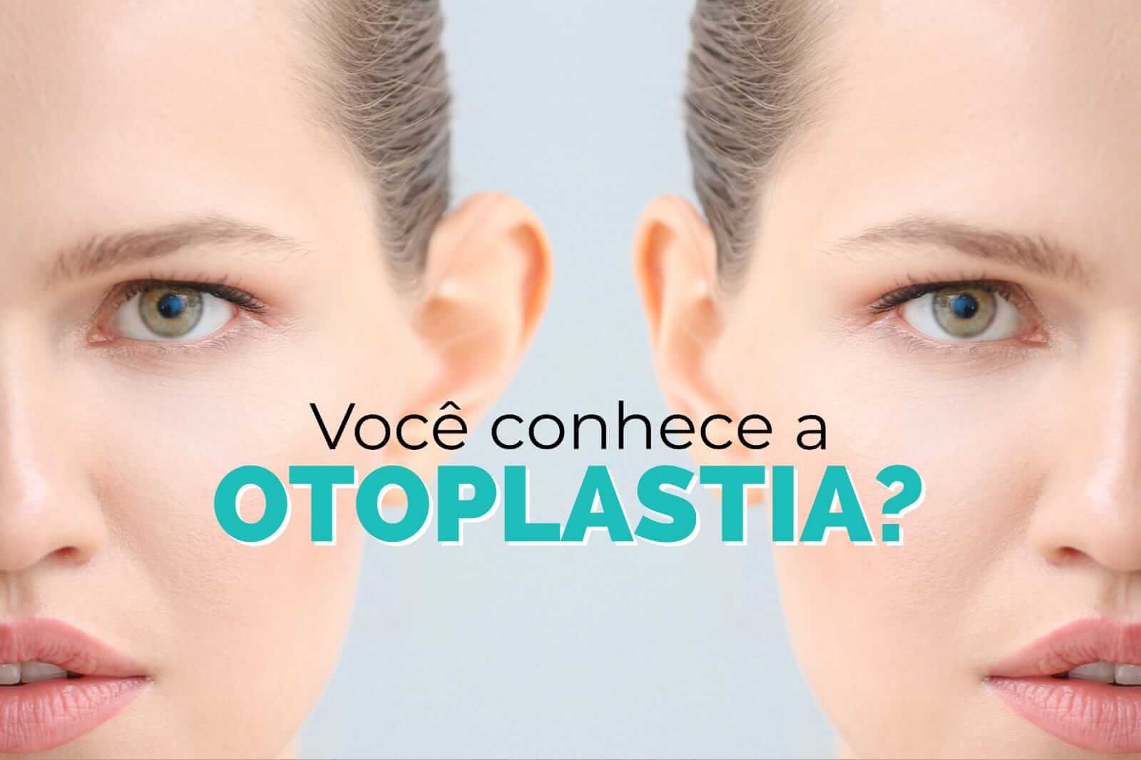 Você conhece a Otoplastia?