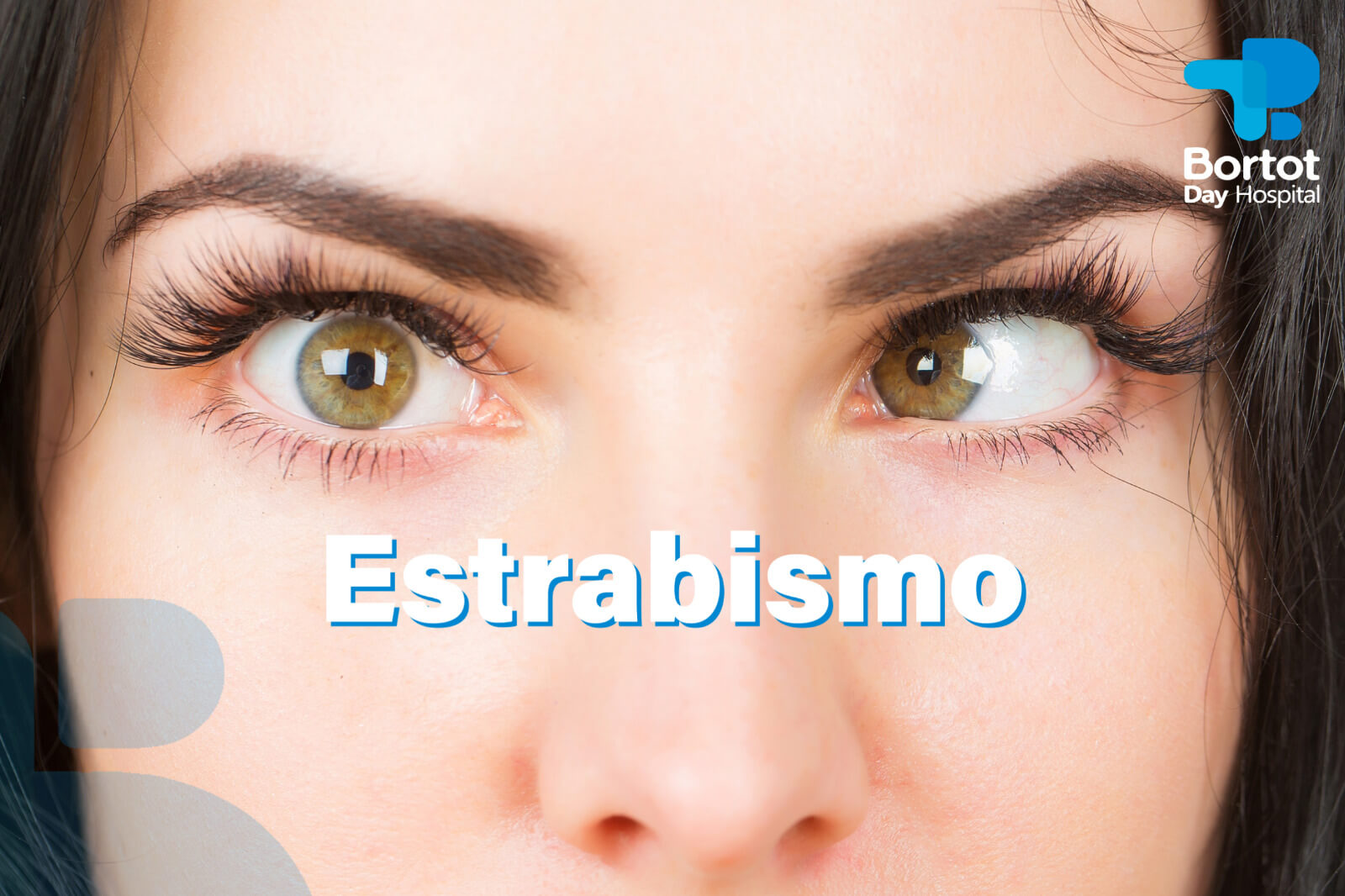 Estrabismo