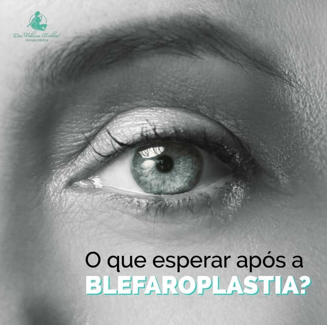 Rejuvenesça seu olhar com a Blefaroplastia