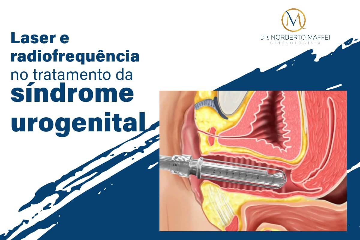 Laser e radiofrequência no tratamento da Síndrome uro-genital