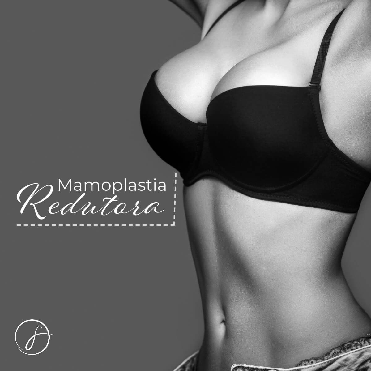 Mamoplastia redutora