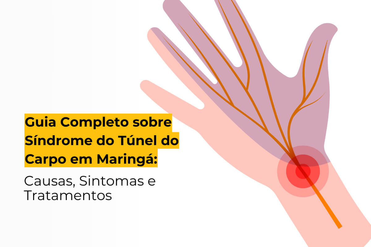 Guia Completo sobre Síndrome do Túnel do Carpo em Maringá: Causas, Sintomas e Tratamentos