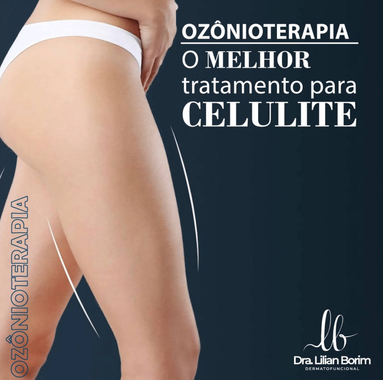 tratamento da celulite com ozonioterapia