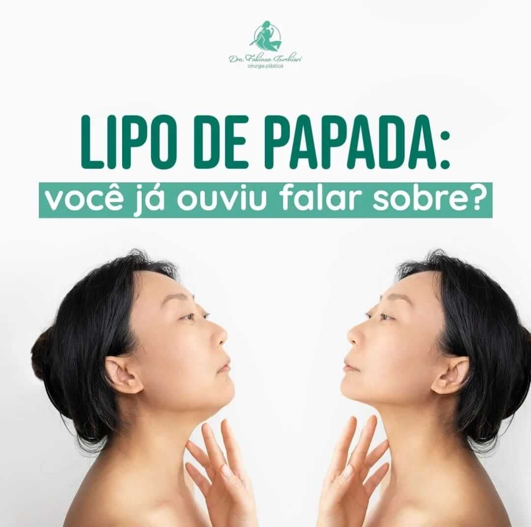 Lipo de papada: você já ouviu falar sobre? - Guia Saúde Cidades