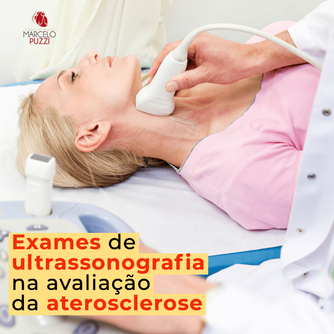 Exames de ultrassonografia na avaliação da aterosclerose 