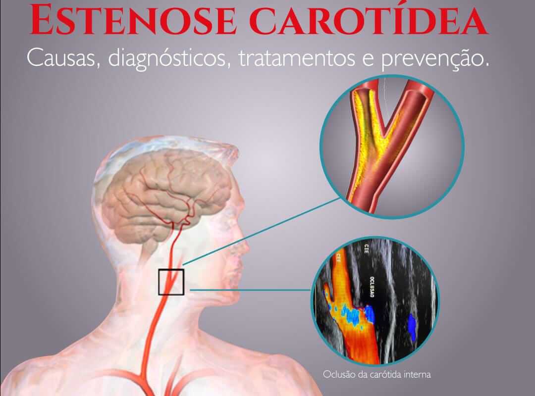 31-01-2022-1643659459475c9b5c8dcbe6e3feada95443ae14a6.jpeg