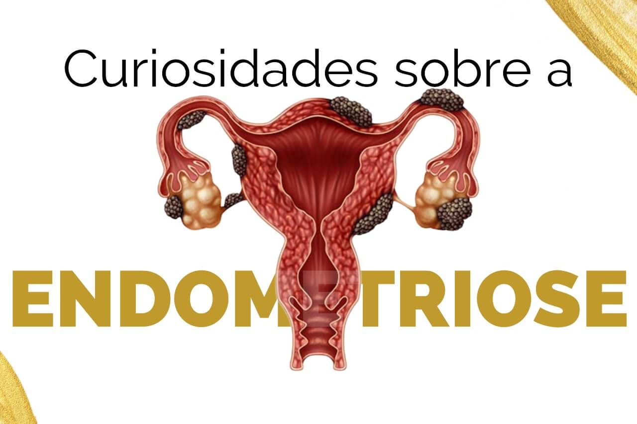 Curiosidades sobre a endometriose 