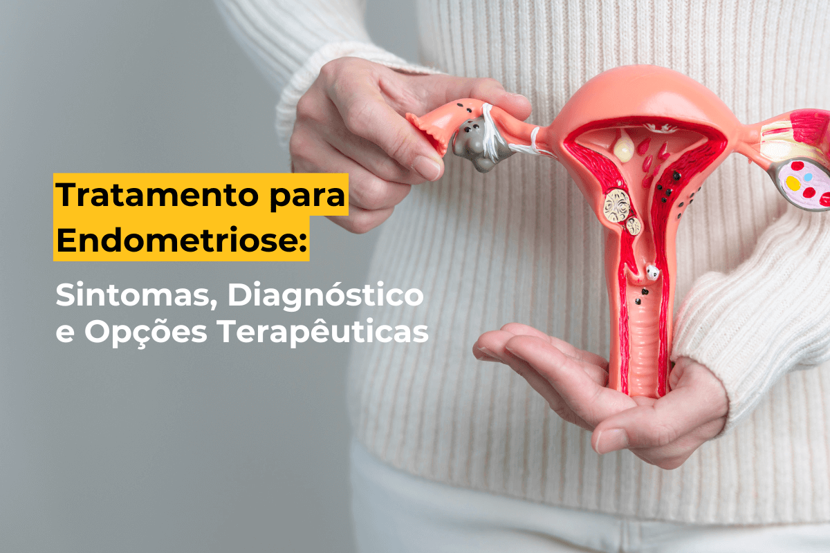Tratamento para Endometriose em Maringá: Sintomas, Diagnóstico e Opções Terapêuticas
